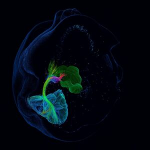 Une image 3D du cerveau pour mieux cibler la radioth&eacute;rapie des tumeurs c&eacute;r&eacute;brales et prot&eacute;ger le cerveau