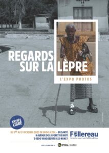 [Expo] « Regards sur la lèpre : expo photos » à la BU Santé